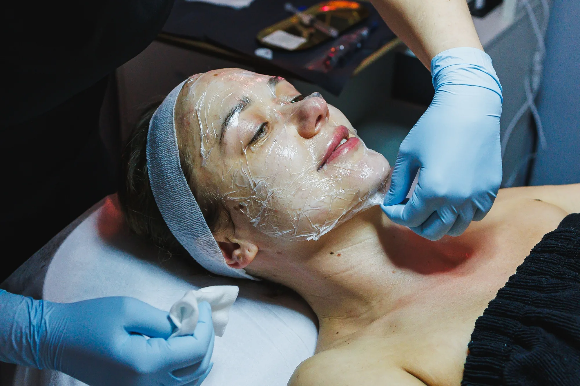 Gloved hands peeling a clear plastic film mask off a client's face during a cosmetic procedure